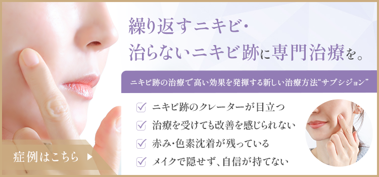 繰り返すニキビ・治らないニキビ跡に専門治療を。