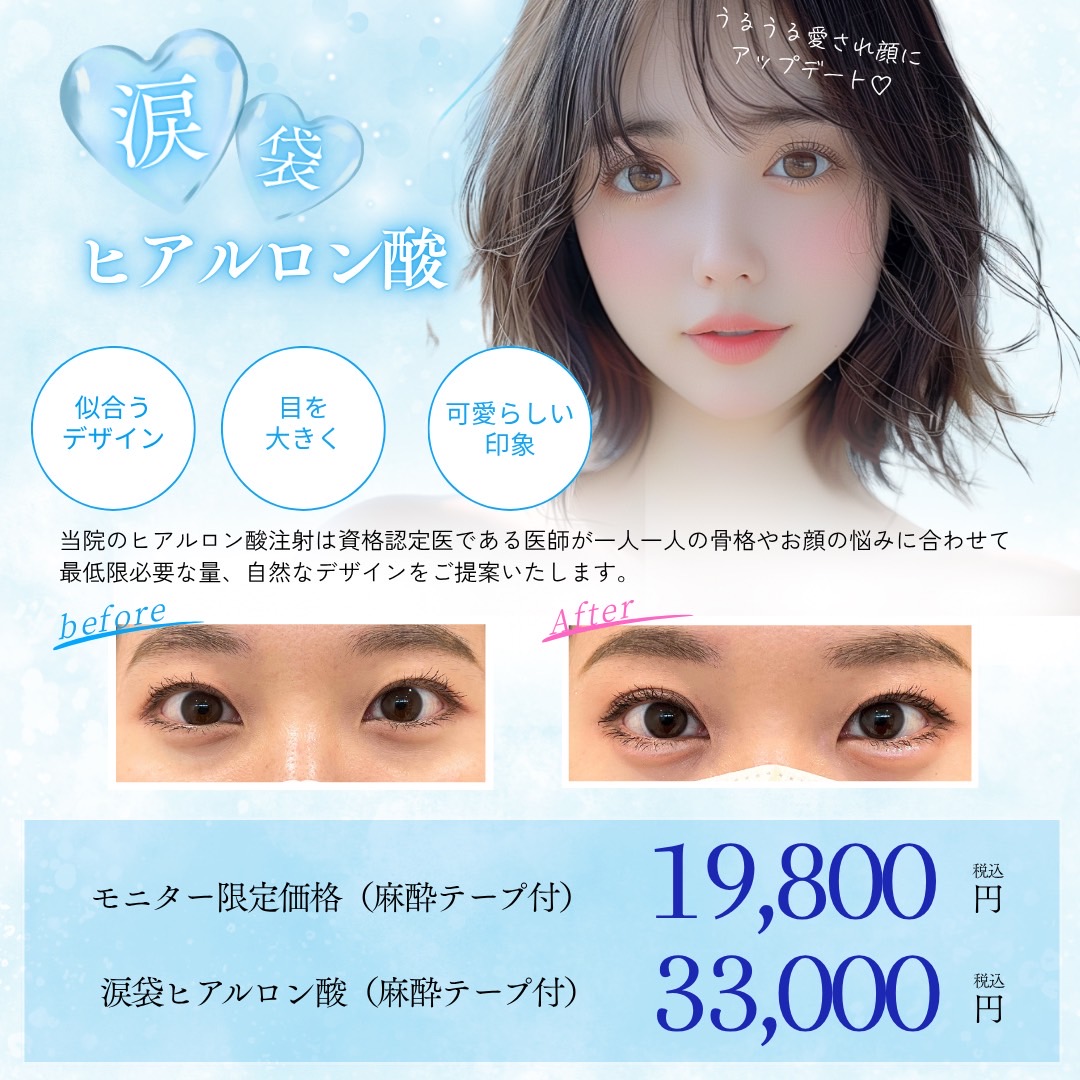涙袋ヒアルロン酸